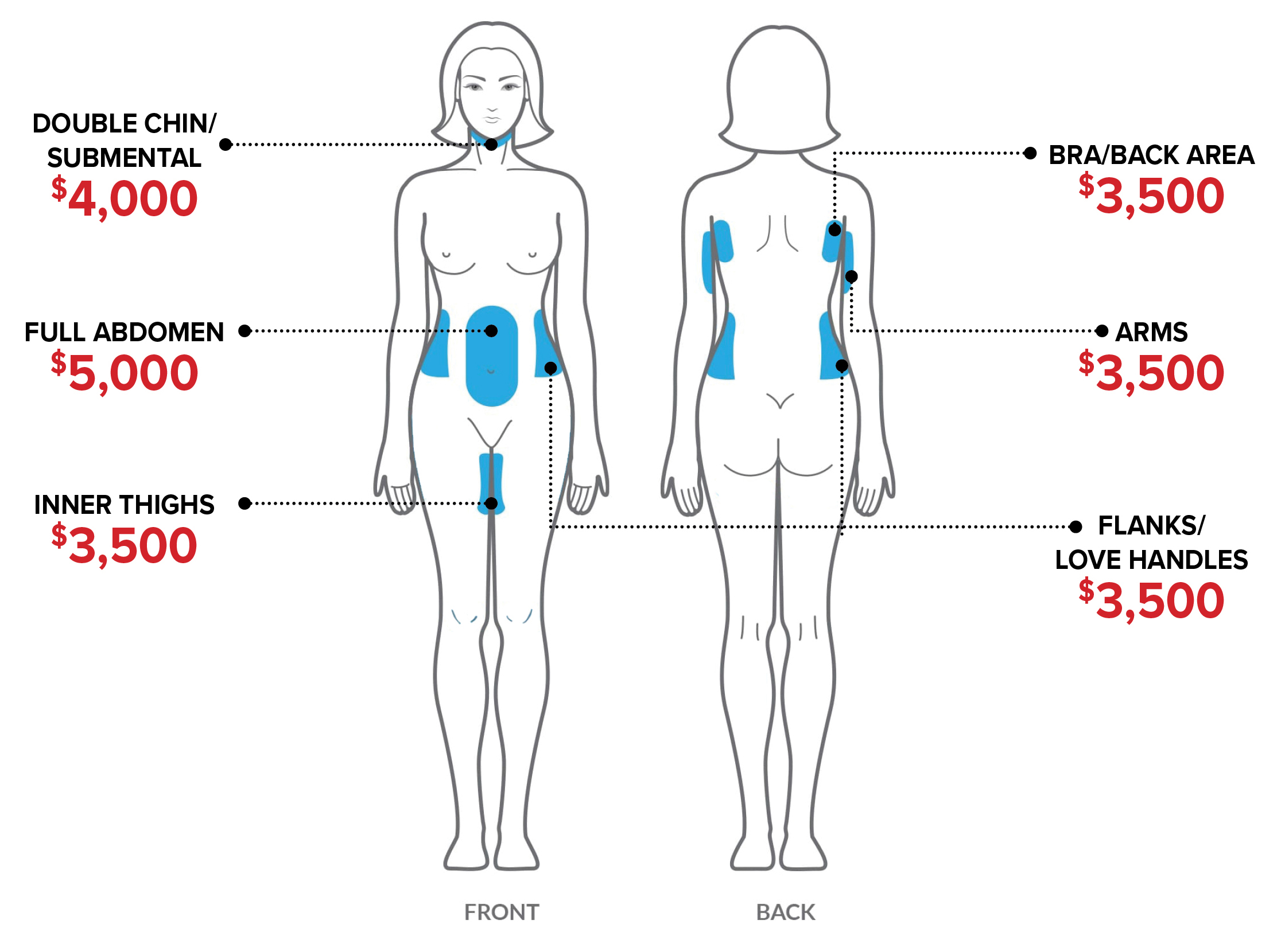 SBMS CoolSculpting Treatment Areas